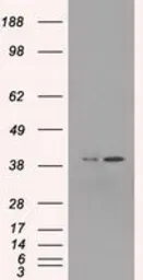 Anti-ERK2 antibody [6E5] used in Western Blot (WB). GTX84159