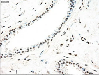 Anti-SEK1 / MKK4 antibody [4B4] used in IHC (Paraffin sections) (IHC-P). GTX84161
