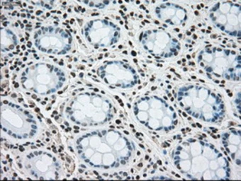 Anti-SEK1 / MKK4 antibody [4B4] used in IHC (Paraffin sections) (IHC-P). GTX84161