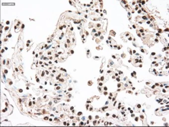 Anti-SEK1 / MKK4 antibody [4B4] used in IHC (Paraffin sections) (IHC-P). GTX84161