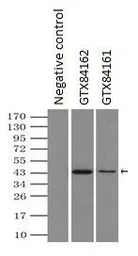 Anti-SEK1 / MKK4 antibody [4B4] used in Immunoprecipitation (IP). GTX84161