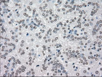 Anti-SEK1 / MKK4 antibody [8A8] used in IHC (Paraffin sections) (IHC-P). GTX84162