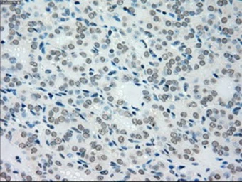 Anti-SEK1 / MKK4 antibody [8A8] used in IHC (Paraffin sections) (IHC-P). GTX84162