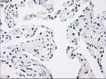 Anti-SEK1 / MKK4 antibody [8A8] used in IHC (Paraffin sections) (IHC-P). GTX84162