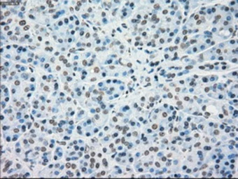 Anti-SEK1 / MKK4 antibody [8A8] used in IHC (Paraffin sections) (IHC-P). GTX84162