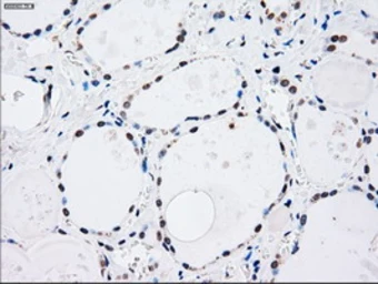 Anti-SEK1 / MKK4 antibody [8A8] used in IHC (Paraffin sections) (IHC-P). GTX84162