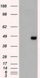 Anti-SEK1 / MKK4 antibody [8A8] used in Western Blot (WB). GTX84162
