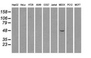 Anti-SEK1 / MKK4 antibody [8A8] used in Western Blot (WB). GTX84162