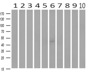 Anti-SEK1 / MKK4 antibody [8A8] used in Western Blot (WB). GTX84162