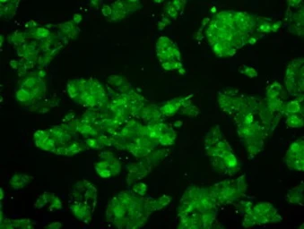 Anti-SEK1 / MKK4 antibody [8A8] used in Immunocytochemistry/ Immunofluorescence (ICC/IF). GTX84162