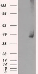 Anti-MEK1 antibody [1C1] used in Western Blot (WB). GTX84168