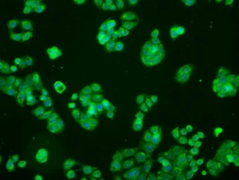 Anti-MEK1 antibody [1C1] used in Immunocytochemistry/ Immunofluorescence (ICC/IF). GTX84168