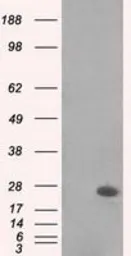 Anti-MAD2L1 antibody [4D2] used in Western Blot (WB). GTX84169