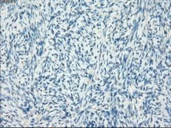 Anti-LTA4H antibody [1E9] used in IHC (Paraffin sections) (IHC-P). GTX84170