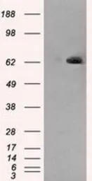 Anti-LTA4H antibody [8F4] used in Western Blot (WB). GTX84171
