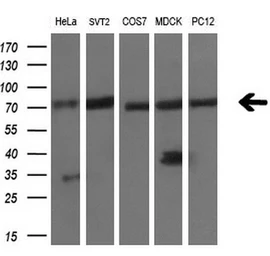 Anti-LTA4H antibody [9C5] used in Western Blot (WB). GTX84176