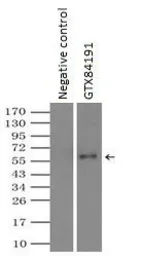 Anti-Endothelial Lipase / LIPG antibody [4A8] used in Immunoprecipitation (IP). GTX84191