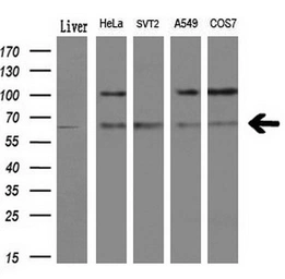 Anti-Endothelial Lipase / LIPG antibody [4A8] used in Western Blot (WB). GTX84191