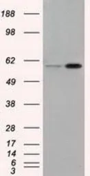 Anti-Endothelial Lipase / LIPG antibody [4A8] used in Western Blot (WB). GTX84191