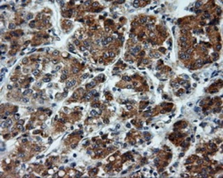 Anti-Endothelial Lipase / LIPG antibody [7C2] used in IHC (Paraffin sections) (IHC-P). GTX84193
