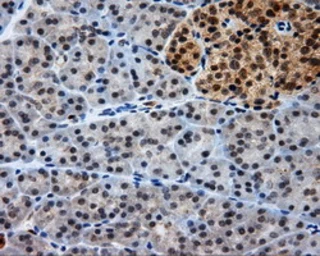 Anti-Endothelial Lipase / LIPG antibody [7C2] used in IHC (Paraffin sections) (IHC-P). GTX84193