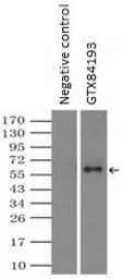 Anti-Endothelial Lipase / LIPG antibody [7C2] used in Immunoprecipitation (IP). GTX84193