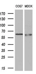 Anti-Endothelial Lipase / LIPG antibody [7C2] used in Western Blot (WB). GTX84193