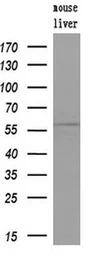 Anti-Endothelial Lipase / LIPG antibody [7C2] used in Western Blot (WB). GTX84193
