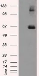 Anti-Endothelial Lipase / LIPG antibody [7C2] used in Western Blot (WB). GTX84193