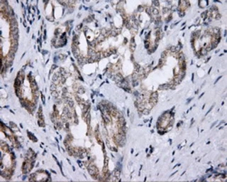 Anti-Endothelial Lipase / LIPG antibody [2A5] used in IHC (Paraffin sections) (IHC-P). GTX84195