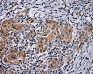 Anti-Endothelial Lipase / LIPG antibody [2A5] used in IHC (Paraffin sections) (IHC-P). GTX84195