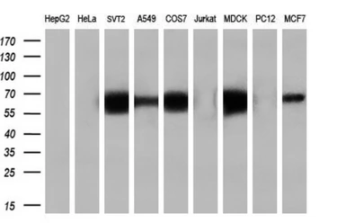 Anti-Endothelial Lipase / LIPG antibody [2A5] used in Western Blot (WB). GTX84195