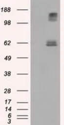 Anti-Endothelial Lipase / LIPG antibody [2A5] used in Western Blot (WB). GTX84195