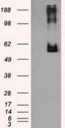 Anti-Endothelial Lipase / LIPG antibody [1B8] used in Western Blot (WB). GTX84209