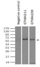 Anti-Endothelial Lipase / LIPG antibody [3G7] used in Immunoprecipitation (IP). GTX84211