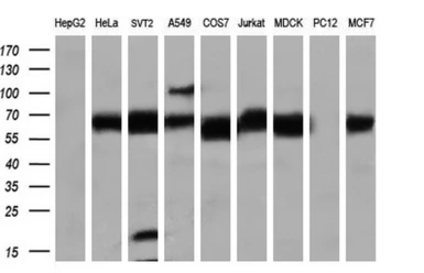 Anti-Endothelial Lipase / LIPG antibody [3G7] used in Western Blot (WB). GTX84211