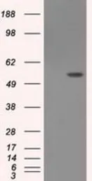 Anti-Endothelial Lipase / LIPG antibody [3G7] used in Western Blot (WB). GTX84211
