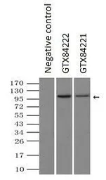 Anti-LEMD3 antibody [3H2] used in Immunoprecipitation (IP). GTX84222