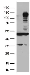 Anti-LEMD3 antibody [3H2] used in Western Blot (WB). GTX84222