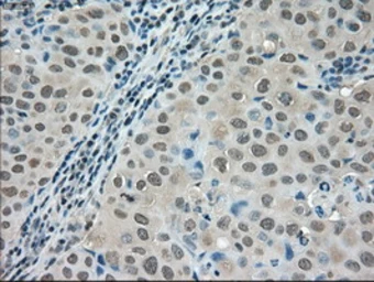 Anti-LDHA antibody [5G10] used in IHC (Paraffin sections) (IHC-P). GTX84226