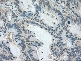 Anti-LDHA antibody [5G10] used in IHC (Paraffin sections) (IHC-P). GTX84226
