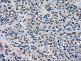 Anti-LDHA antibody [5G10] used in IHC (Paraffin sections) (IHC-P). GTX84226