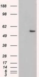 Anti-Cytokeratin 8 antibody [1B9] used in Western Blot (WB). GTX84247