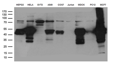 Anti-Cytokeratin 8 antibody [1B9] used in Western Blot (WB). GTX84247