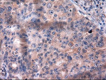 Anti-Cytokeratin 18 antibody [5E8] used in IHC (Paraffin sections) (IHC-P). GTX84255