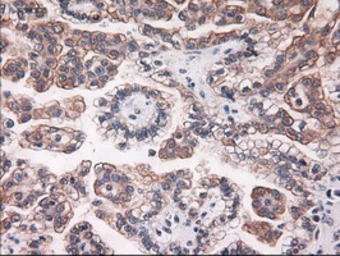 Anti-Cytokeratin 18 antibody [5E8] used in IHC (Paraffin sections) (IHC-P). GTX84255
