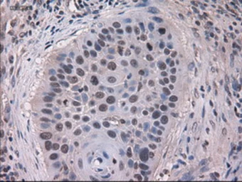 Anti-Cytokeratin 18 antibody [5E8] used in IHC (Paraffin sections) (IHC-P). GTX84255