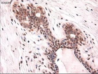 Anti-Cytokeratin 18 antibody [5E8] used in IHC (Paraffin sections) (IHC-P). GTX84255
