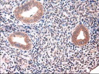 Anti-Cytokeratin 18 antibody [5E8] used in IHC (Paraffin sections) (IHC-P). GTX84255