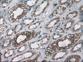 Anti-Cytokeratin 18 antibody [5E8] used in IHC (Paraffin sections) (IHC-P). GTX84255